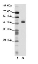 ZNF213 Antibody - A: Marker, B: HepG2 Cell Lysate.  This image was taken for the unconjugated form of this product. Other forms have not been tested.