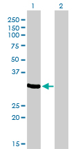 ZNF215 Antibody - Western Blot analysis of ZNF215 expression in transfected 293T cell line by ZNF215 monoclonal antibody (M01), clone 2C11.Lane 1: ZNF215 transfected lysate(35.3 KDa).Lane 2: Non-transfected lysate.