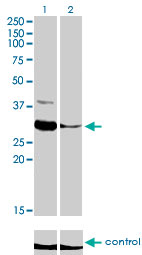 ZNF215 Antibody - Western blot analysis of ZNF215 over-expressed 293 cell line, cotransfected with ZNF215 Validated Chimera RNAi (Lane 2) or non-transfected control (Lane 1). Blot probed with ZNF215 monoclonal antibody (M01), clone 2C11 . GAPDH ( 36.1 kDa ) used as specificity and loading control.
