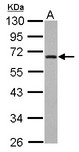 ZNF215 Antibody - Sample (30 ug of whole cell lysate) A: A431 10% SDS PAGE ZNF215 antibody diluted at 1:1000