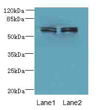 ZNF215 Antibody - Western blot. All lanes: ZNF215 antibody at 3 ug/ml. Lane 1: HeLa whole cell lysate. Lane 2: A431 whole cell lysate. Secondary Goat polyclonal to Rabbit IgG at 1:10000 dilution. Predicted band size: 60 kDa. Observed band size: 60 kDa.