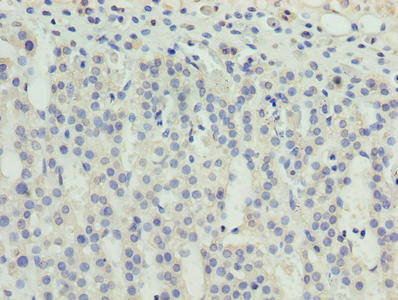 ZNF215 Antibody - Immunohistochemistry of paraffin-embedded human adrenal gland tissue using ZNF215 Antibody at dilution of 1:100