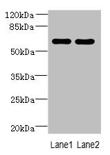 ZNF215 Antibody - Western blot All lanes: ZNF215 antibody at 3µg/ml Lane 1: Hela whole cell lysate Lane 2: A431 whole cell lysate Secondary Goat polyclonal to rabbit IgG at 1/10000 dilution Predicted band size: 61, 36 kDa Observed band size: 61 kDa