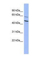 ZNF215 Antibody - ZNF215 antibody Western blot of THP-1 cell lysate. This image was taken for the unconjugated form of this product. Other forms have not been tested.