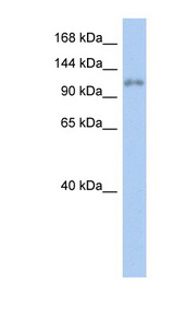 ZNF217 Antibody - ZNF217 antibody Western blot of Fetal stomach lysate. This image was taken for the unconjugated form of this product. Other forms have not been tested.