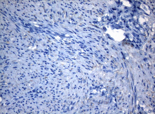 ZNF217 Antibody - Immunohistochemical staining of paraffin-embedded Human endometrium tissue within the normal limits using anti-ZNF217 mouse monoclonal antibody. (Heat-induced epitope retrieval by 1mM EDTA in 10mM Tris buffer. (pH8.5) at 120°C for 3 min. (1:150)