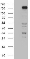 ZNF217 Antibody - HEK293T cells were transfected with the pCMV6-ENTRY control. (Left lane) or pCMV6-ENTRY ZNF217. (Right lane) cDNA for 48 hrs and lysed. Equivalent amounts of cell lysates. (5 ug per lane) were separated by SDS-PAGE and immunoblotted with anti-ZNF217. (1:2000)