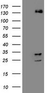 ZNF217 Antibody - HEK293T cells were transfected with the pCMV6-ENTRY control. (Left lane) or pCMV6-ENTRY ZNF217. (Right lane) cDNA for 48 hrs and lysed