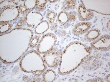 ZNF217 Antibody - Immunohistochemical staining of paraffin-embedded Human thyroid tissue within the normal limits using anti-ZNF217 mouse monoclonal antibody. (Heat-induced epitope retrieval by 1mM EDTA in 10mM Tris buffer. (pH8.5) at 120°C for 3 min. (1:150)