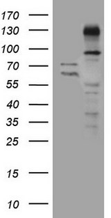 ZNF217 Antibody - HEK293T cells were transfected with the pCMV6-ENTRY control. (Left lane) or pCMV6-ENTRY ZNF217. (Right lane) cDNA for 48 hrs and lysed
