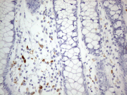 ZNF217 Antibody - Immunohistochemical staining of paraffin-embedded Human colon tissue within the normal limits using anti-ZNF217 mouse monoclonal antibody. (Heat-induced epitope retrieval by 1mM EDTA in 10mM Tris buffer. (pH8.5) at 120°C for 3 min. (1:150)