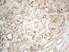 ZNF217 Antibody - Immunohistochemical staining of paraffin-embedded Human thyroid tissue within the normal limits using anti-ZNF217 mouse monoclonal antibody. (Heat-induced epitope retrieval by 1mM EDTA in 10mM Tris buffer. (pH8.5) at 120°C for 3 min. (1:150)
