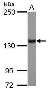 ZNF217 Antibody - Sample (30 ug of whole cell lysate) A: IMR32 5% SDS PAGE ZNF217 antibody diluted at 1:1000