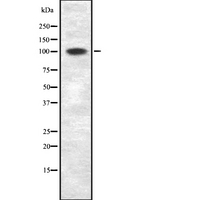 ZNF217 Antibody - Western blot analysis of ZNF217 using HT29 whole cells lysates