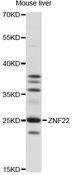 ZNF22 Antibody - Western blot analysis of extracts of mouse liver, using ZNF22 antibody at 1:1000 dilution. The secondary antibody used was an HRP Goat Anti-Rabbit IgG (H+L) at 1:10000 dilution. Lysates were loaded 25ug per lane and 3% nonfat dry milk in TBST was used for blocking. An ECL Kit was used for detection and the exposure time was 30s.