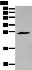 ZNF22 Antibody - Western blot analysis of Jurkat cell  using ZNF22 Polyclonal Antibody at dilution of 1:400