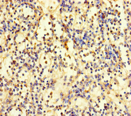 ZNF221 Antibody - Immunohistochemistry of paraffin-embedded human spleen tissue using ZNF221 Antibody at dilution of 1:100