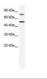ZNF223 Antibody - Jurkat Cell Lysate.  This image was taken for the unconjugated form of this product. Other forms have not been tested.