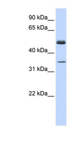 ZNF223 Antibody - ZNF223 antibody Western blot of Fetal Muscle lysate. This image was taken for the unconjugated form of this product. Other forms have not been tested.