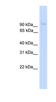 ZNF224 Antibody - ZNF224 antibody Western blot of Fetal Muscle lysate. This image was taken for the unconjugated form of this product. Other forms have not been tested.
