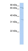 ZNF224 Antibody - ZNF224 antibody Western blot of Jurkat lysate. This image was taken for the unconjugated form of this product. Other forms have not been tested.