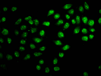ZNF224 Antibody - Immunofluorescence staining of Hela cells diluted at 1:166, counter-stained with DAPI. The cells were fixed in 4% formaldehyde, permeabilized using 0.2% Triton X-100 and blocked in 10% normal Goat Serum. The cells were then incubated with the antibody overnight at 4°C.The Secondary antibody was Alexa Fluor 488-congugated AffiniPure Goat Anti-Rabbit IgG (H+L).