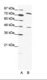 ZNF225 Antibody - A: Marker, B: HepG2 Cell Lysate.  This image was taken for the unconjugated form of this product. Other forms have not been tested.