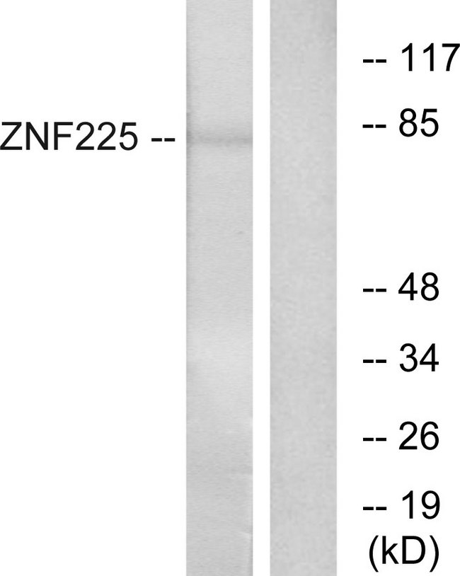ZNF225 Antibody - Western blot analysis of lysates from HeLa cells, using ZNF225 Antibody. The lane on the right is blocked with the synthesized peptide.