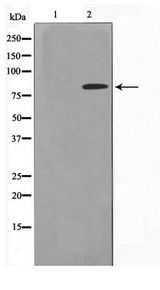 ZNF225 Antibody - Western blot of HeLa cell lysate using ZNF225 Antibody