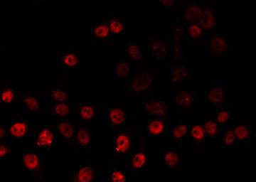 ZNF225 Antibody - Staining HeLa cells by IF/ICC. The samples were fixed with PFA and permeabilized in 0.1% Triton X-100, then blocked in 10% serum for 45 min at 25°C. The primary antibody was diluted at 1:200 and incubated with the sample for 1 hour at 37°C. An Alexa Fluor 594 conjugated goat anti-rabbit IgG (H+L) Ab, diluted at 1/600, was used as the secondary antibody.
