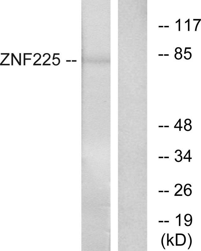 ZNF225 Antibody - Western blot analysis of extracts from HeLa cells, using ZNF225 antibody.