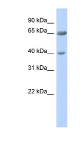 ZNF226 Antibody - ZNF226 antibody Western blot of Fetal Pancreas lysate. This image was taken for the unconjugated form of this product. Other forms have not been tested.