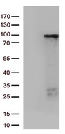 ZNF226 Antibody - HEK293T cells were transfected with the pCMV6-ENTRY control. (Left lane) or pCMV6-ENTRY ZNF226. (Right lane) cDNA for 48 hrs and lysed. Equivalent amounts of cell lysates. (5 ug per lane) were separated by SDS-PAGE and immunoblotted with anti-ZNF226. (1:500)