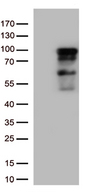 ZNF226 Antibody - HEK293T cells were transfected with the pCMV6-ENTRY control. (Left lane) or pCMV6-ENTRY ZNF226. (Right lane) cDNA for 48 hrs and lysed. Equivalent amounts of cell lysates. (5 ug per lane) were separated by SDS-PAGE and immunoblotted with anti-ZNF226. (1:500)