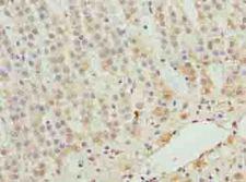 ZNF226 Antibody - Immunohistochemistry of paraffin-embedded human adrenal gland tissue using antibody at dilution of 1:100.