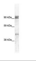 ZNF227 Antibody - Fetal small Intestine Lysate.  This image was taken for the unconjugated form of this product. Other forms have not been tested.