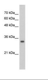 ZNF227 Antibody - HepG2 Cell Lysate.  This image was taken for the unconjugated form of this product. Other forms have not been tested.
