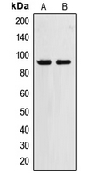 ZNF227 Antibody - Western blot analysis of ZNF227 expression in HepG2 (A); HL60 (B) whole cell lysates.