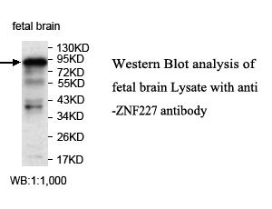 ZNF227 Antibody