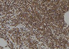 ZNF227 Antibody - 1:100 staining human spleen tissue by IHC-P. The sample was formaldehyde fixed and a heat mediated antigen retrieval step in citrate buffer was performed. The sample was then blocked and incubated with the antibody for 1.5 hours at 22°C. An HRP conjugated goat anti-rabbit antibody was used as the secondary.