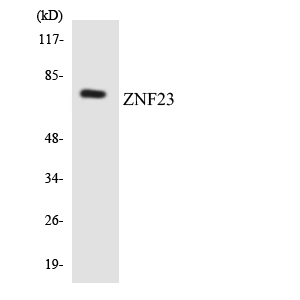 ZNF23 Antibody - Western blot analysis of the lysates from RAW264.7cells using ZNF23 antibody.