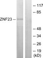 ZNF23 Antibody - Western blot analysis of lysates from LOVO cells, using ZNF23 Antibody. The lane on the right is blocked with the synthesized peptide.