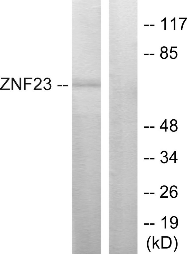 ZNF23 Antibody - Western blot analysis of lysates from LOVO cells, using ZNF23 Antibody. The lane on the right is blocked with the synthesized peptide.