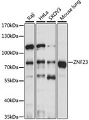 ZNF23 Antibody - Western blot analysis of extracts of various cell lines, using ZNF23 antibody at 1:1000 dilution. The secondary antibody used was an HRP Goat Anti-Rabbit IgG (H+L) at 1:10000 dilution. Lysates were loaded 25ug per lane and 3% nonfat dry milk in TBST was used for blocking. An ECL Kit was used for detection and the exposure time was 10s.