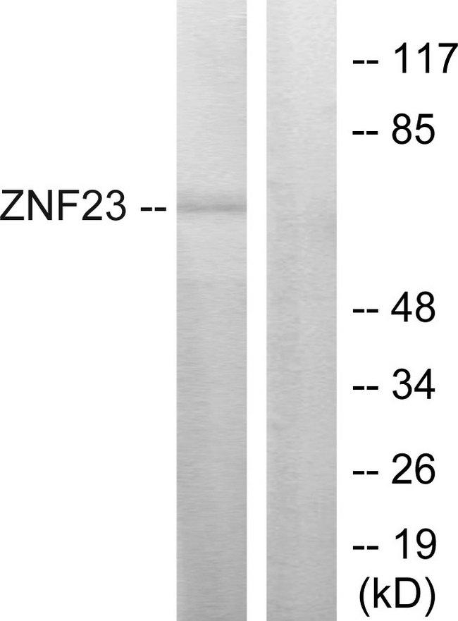 ZNF23 Antibody - Western blot analysis of extracts from LOVO cells, using ZNF23 antibody.