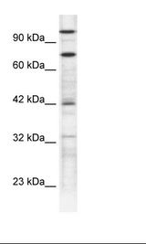 ZNF23 Antibody - Jurkat Cell Lysate.  This image was taken for the unconjugated form of this product. Other forms have not been tested.