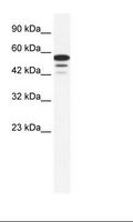 ZNF230 Antibody - Jurkat Cell Lysate.  This image was taken for the unconjugated form of this product. Other forms have not been tested.
