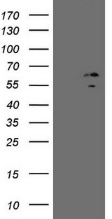 ZNF230 Antibody - HEK293T cells were transfected with the pCMV6-ENTRY control. (Left lane) or pCMV6-ENTRY ZNF230. (Right lane) cDNA for 48 hrs and lysed. Equivalent amounts of cell lysates. (5 ug per lane) were separated by SDS-PAGE and immunoblotted with anti-ZNF230. (1:500)
