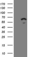 ZNF230 Antibody - HEK293T cells were transfected with the pCMV6-ENTRY control. (Left lane) or pCMV6-ENTRY ZNF230. (Right lane) cDNA for 48 hrs and lysed. Equivalent amounts of cell lysates. (5 ug per lane) were separated by SDS-PAGE and immunoblotted with anti-ZNF230. (1:2000)