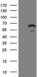 ZNF230 Antibody - HEK293T cells were transfected with the pCMV6-ENTRY control. (Left lane) or pCMV6-ENTRY ZNF230. (Right lane) cDNA for 48 hrs and lysed